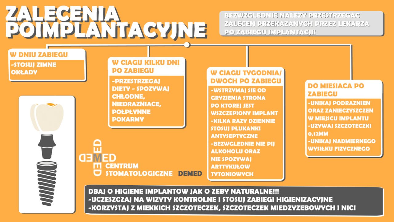 Zalecenia Po Zabiegu Implantacji Centrum Stomatologiczne Demed